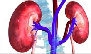 kidney-600x357-1.jpg